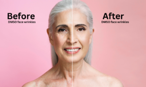 dmso face wrinkles before and after