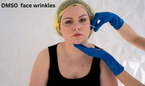 DMSO face wrinkles